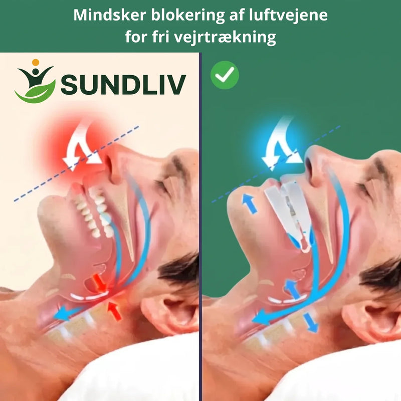 Snorkeskinne Justerbar – Mundskinne med Komfortabel Pasform til Nattebrug