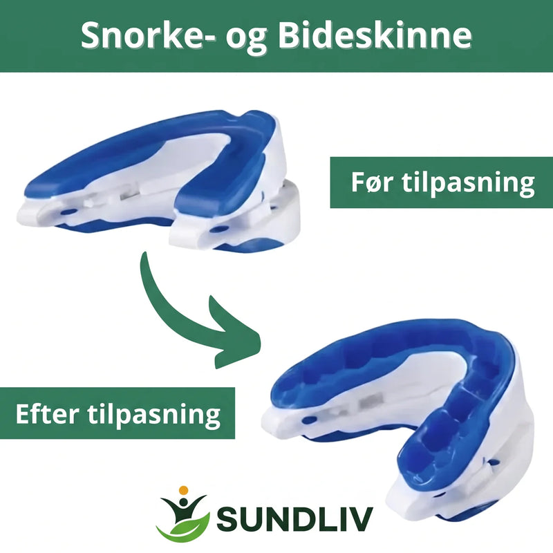 Snorkeskinne Justerbar – Mundskinne med Komfortabel Pasform til Nattebrug